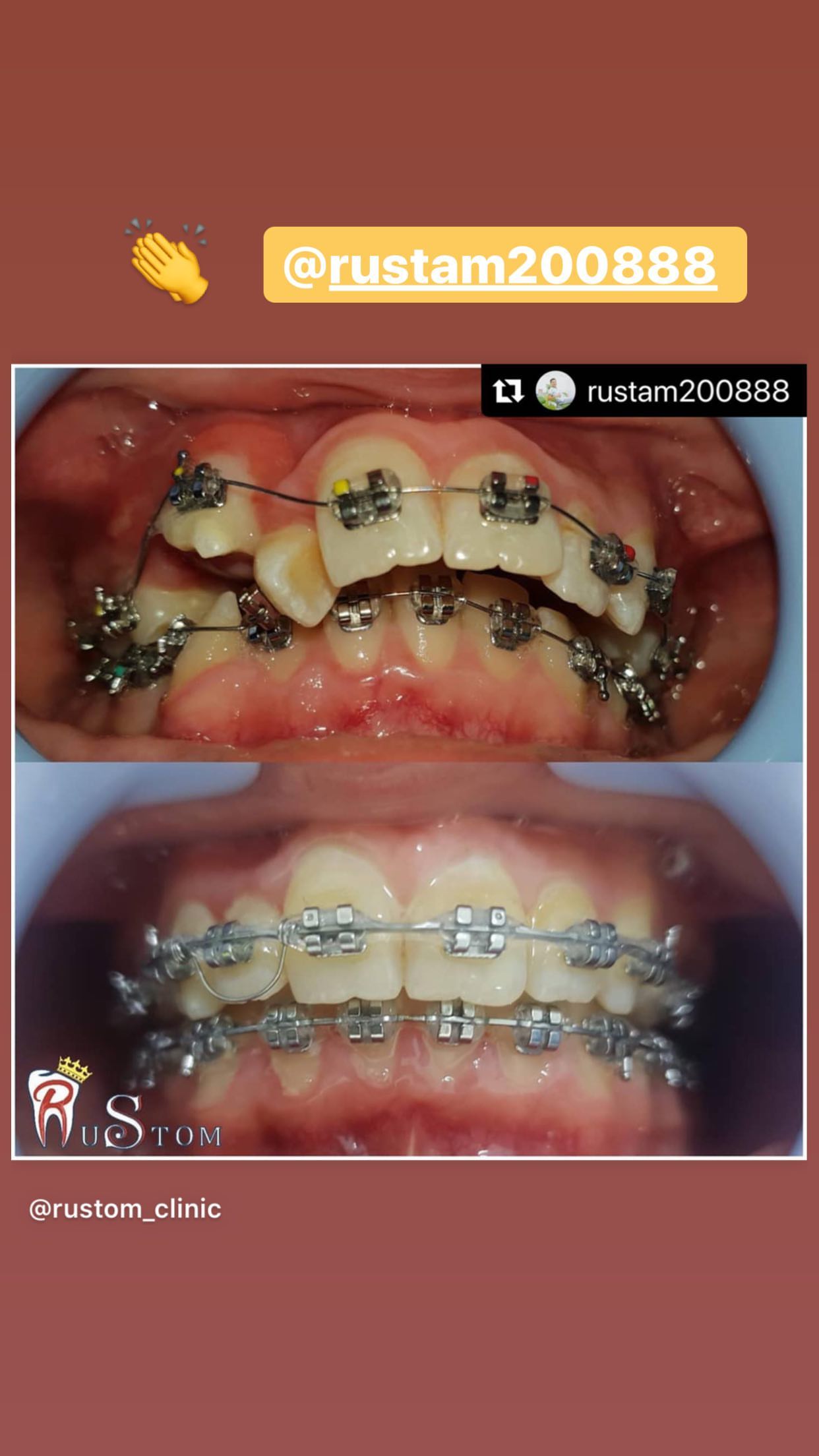 До/После — результат