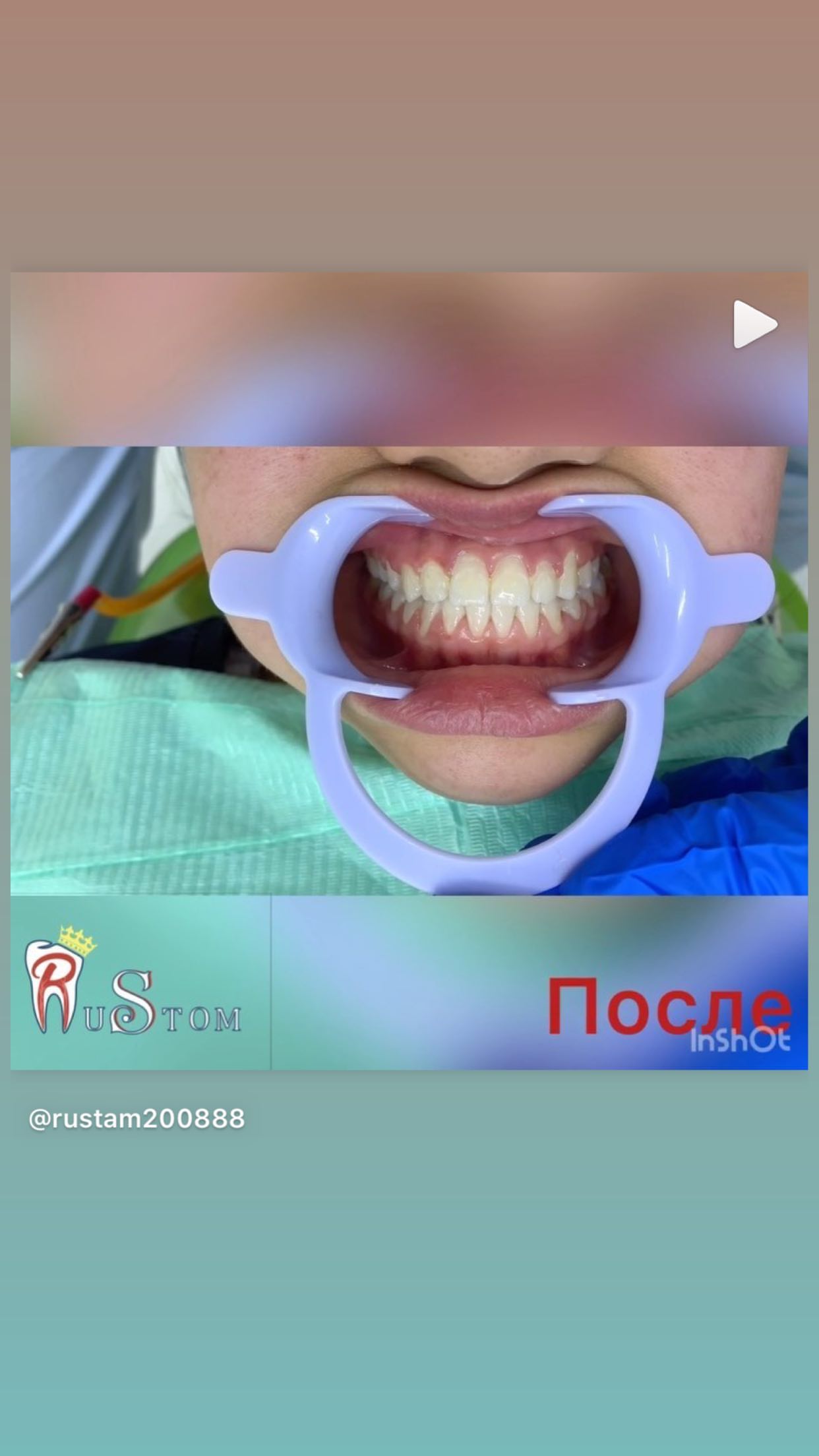 До/После — результат